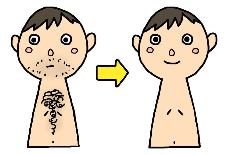 乳頭の大きさ・色味、乳輪のブツブツ 気になる方必見！改善方法や施術についてあやの先生が詳しくお教えします！ モントゴメリー腺除去・乳頭縮小術-新宿本院