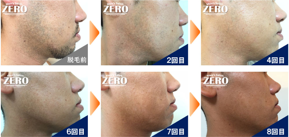 髭 脱毛クリーム」の人気商品一覧安い商品を通販サイトから探す - 価格.com