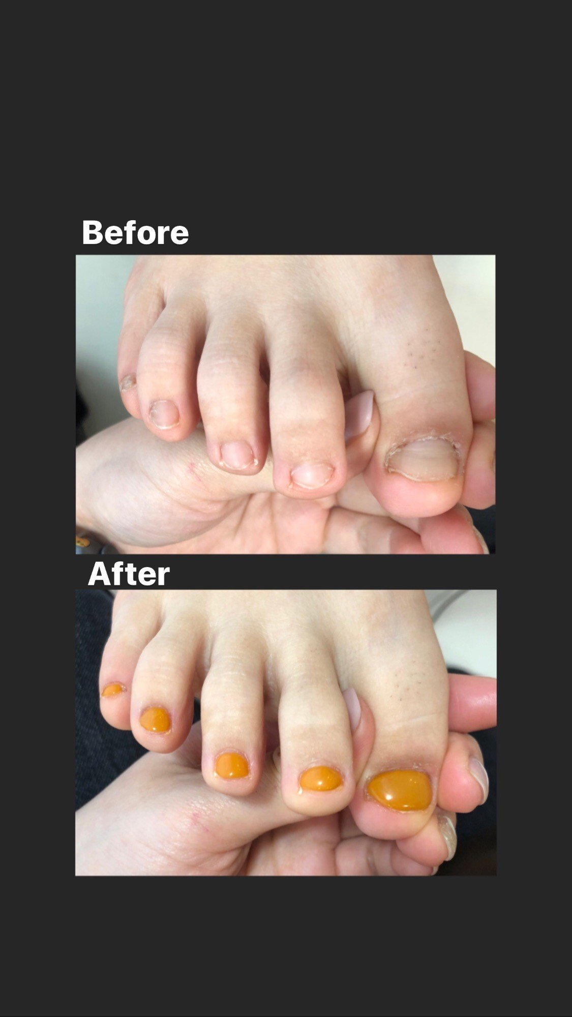 綺麗 足爪の写真素材 - PIXTA