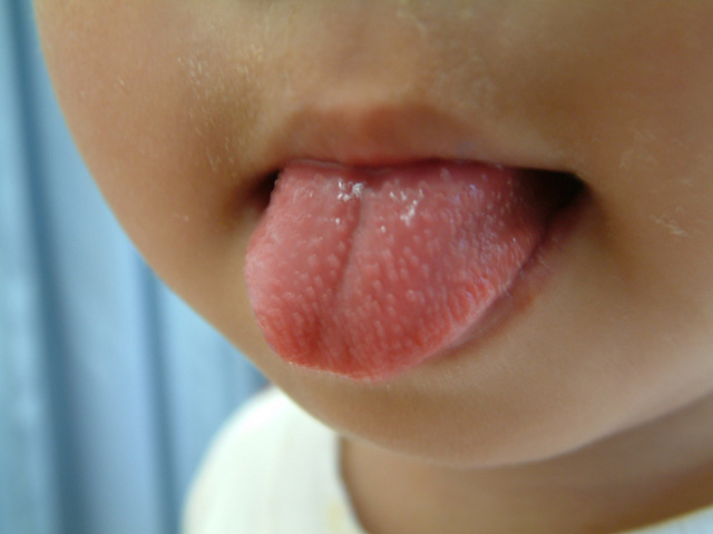 医療従事者監修 鼻の周りにブツブツができる原因と治し方！黒い・赤い・白いときは？ニキビ、ニキビ跡、赤ら顔の改善なら渋谷美容外科クリニック