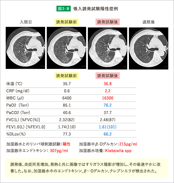 気管支炎とはどのような病気なのか – 症状から治療までの基礎知識 - 神戸きしだクリニック 神戸市中央区