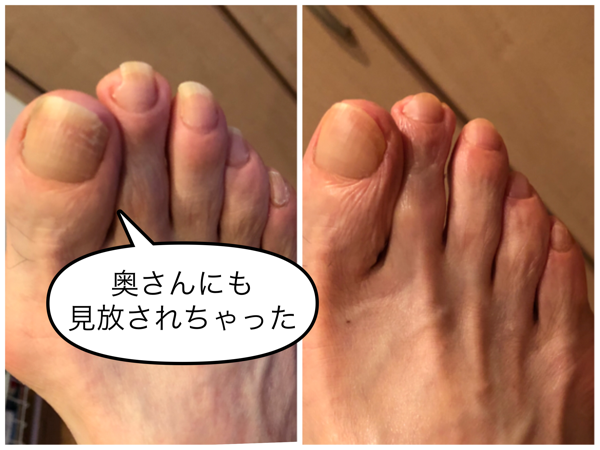 爪が大きい人 ネイルTikTok