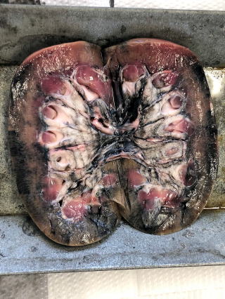 ひと腎臓断面します。の写真素材・画像素材 Image 14671588