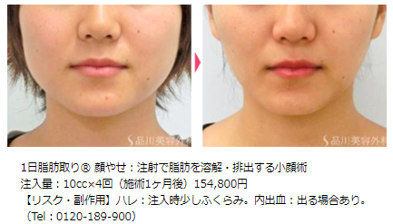 顔痩せ・小顔に効果的な筋トレ、マッサージ、美容施術THE CLINIC