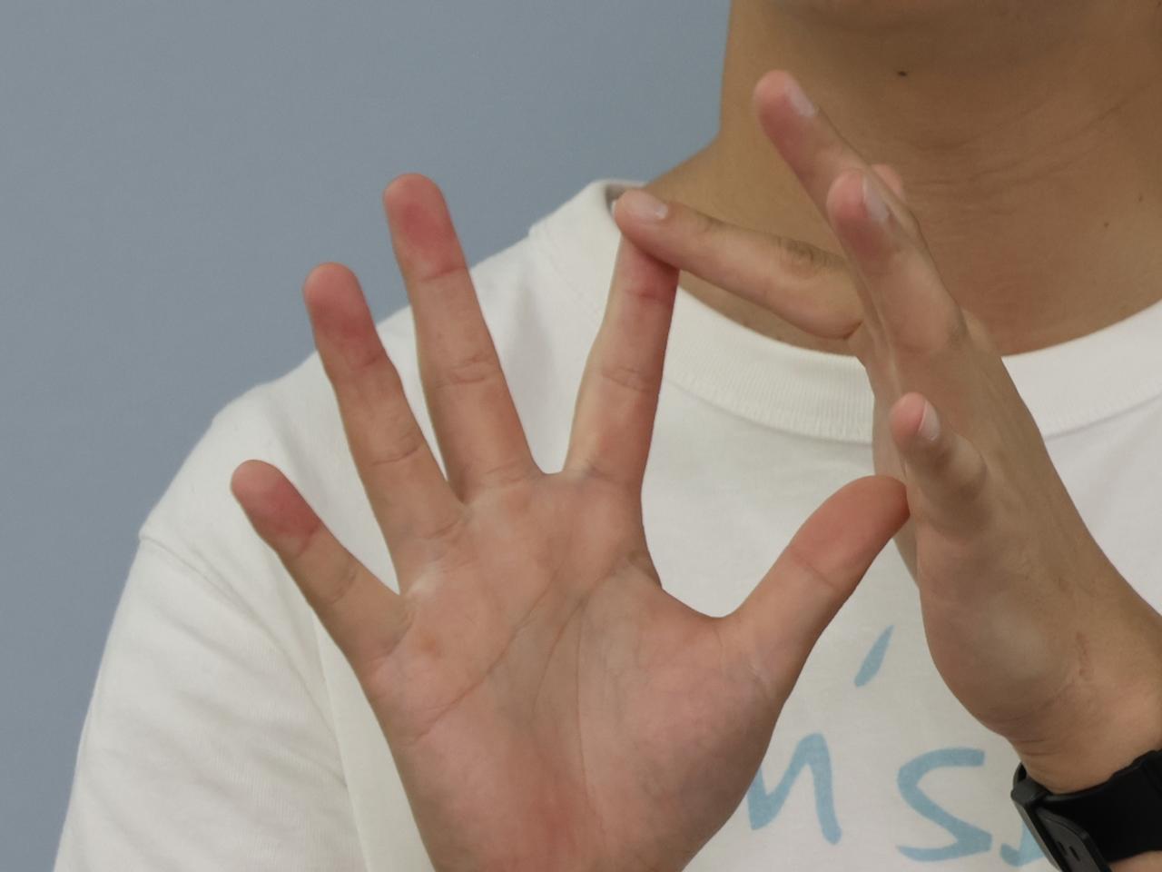 指の腹の写真素材 - PIXTA