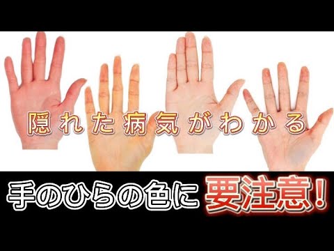 黄疸が腕に現れる原因内出血や他の色素沈着との違いと対処法湘南カイロ茅ヶ崎整体院