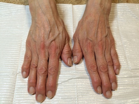 パラフィンパックとは？ ネイルケアやハンドケアにおすすめの理由パラフィンパックの方法を解説モアリジョブ