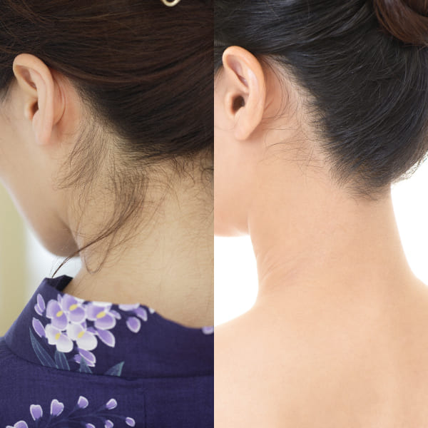 うなじ脱毛はしないほうがいいの？その理由とメリット・デメリットを解説！ - LACOCO COLUMN