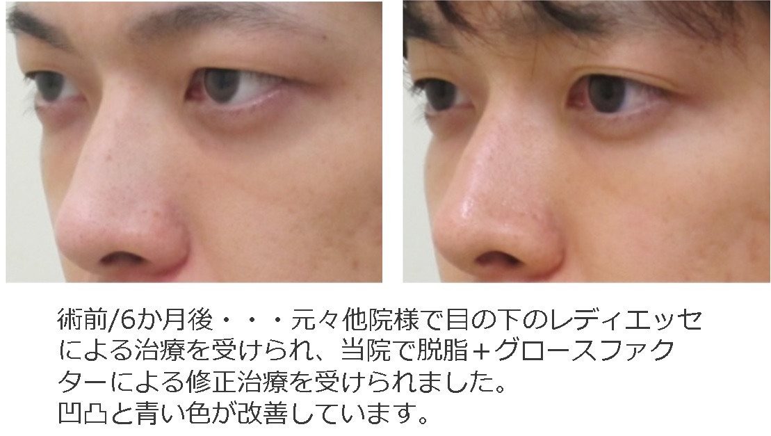 LOVE、儚い失恋を描いた表題曲で見せた深い感情移入。インタビューから窺える11人の最新作での手応え – THE FIRST TIMES