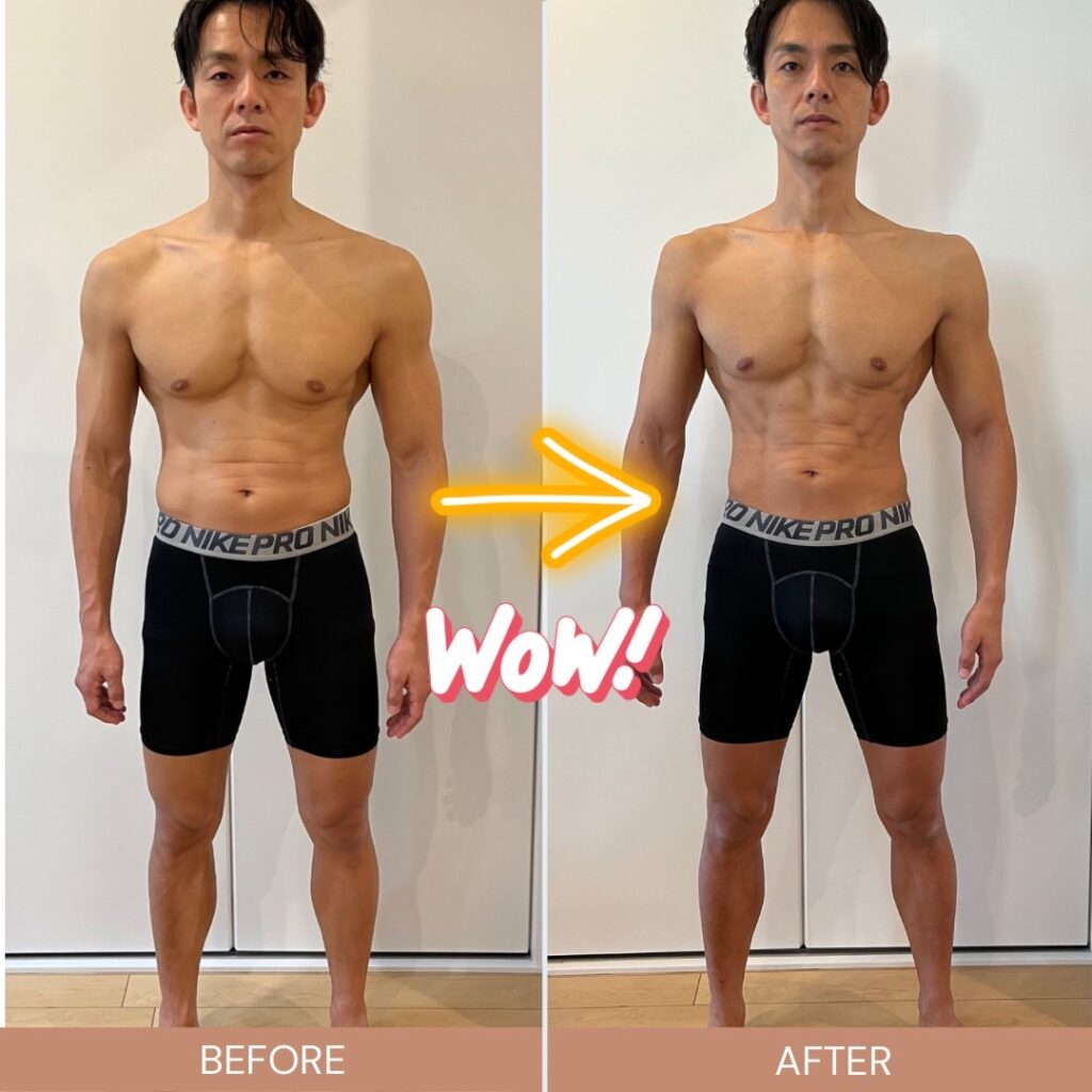 ビフォーアフター有インモードとは？プロが効果やメリットを解説│SELECT CLINIC TIPS