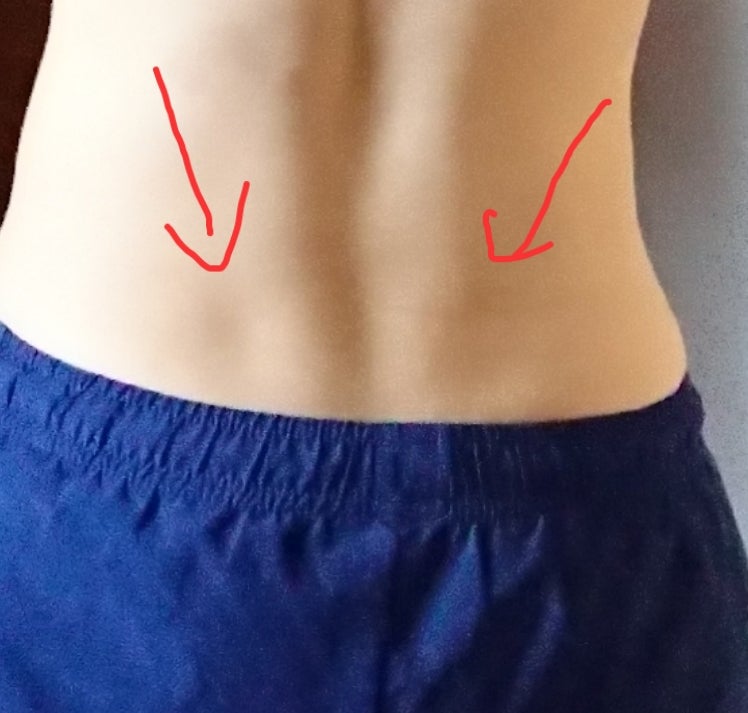 ヴィーナスのえくぼTHE CLINIC 志田雅明 オフィシャルブログ