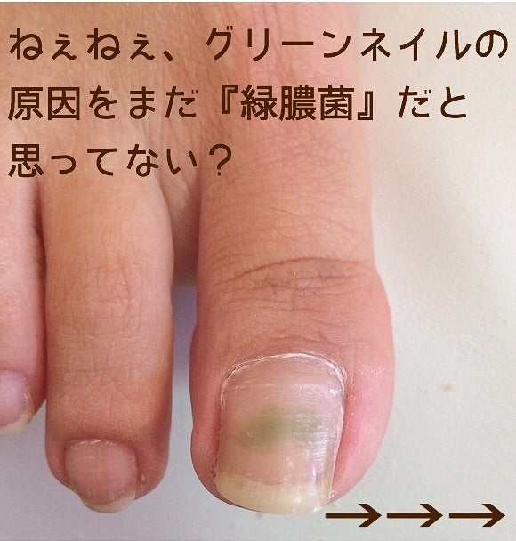 菌種別 <span class=