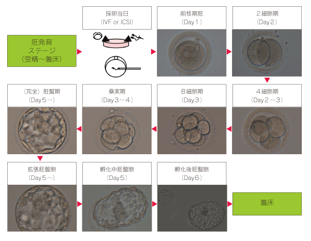 体外受精・顕微授精について扇町レディースクリニック