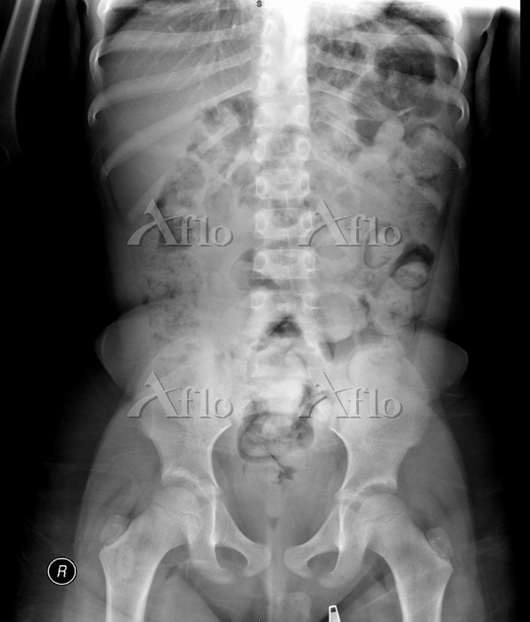 レントゲンいしむら腎泌尿器科クリニック