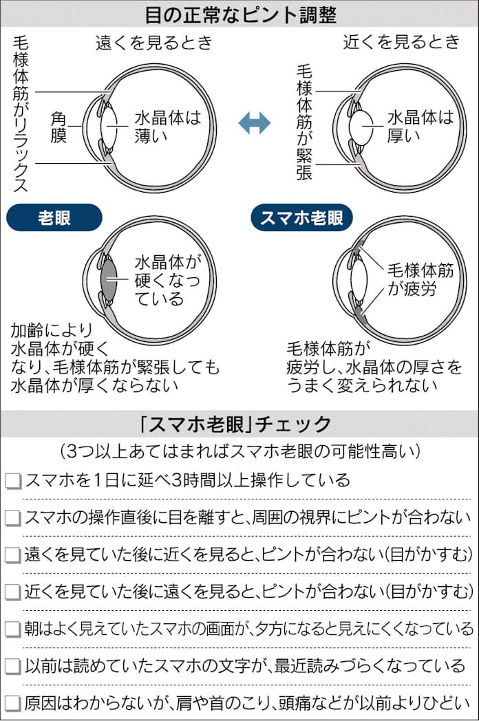 若くても​老眼？​「スマホ老眼」とは？​デジタル眼精疲労の​原因や​対策アキュビュー®公式