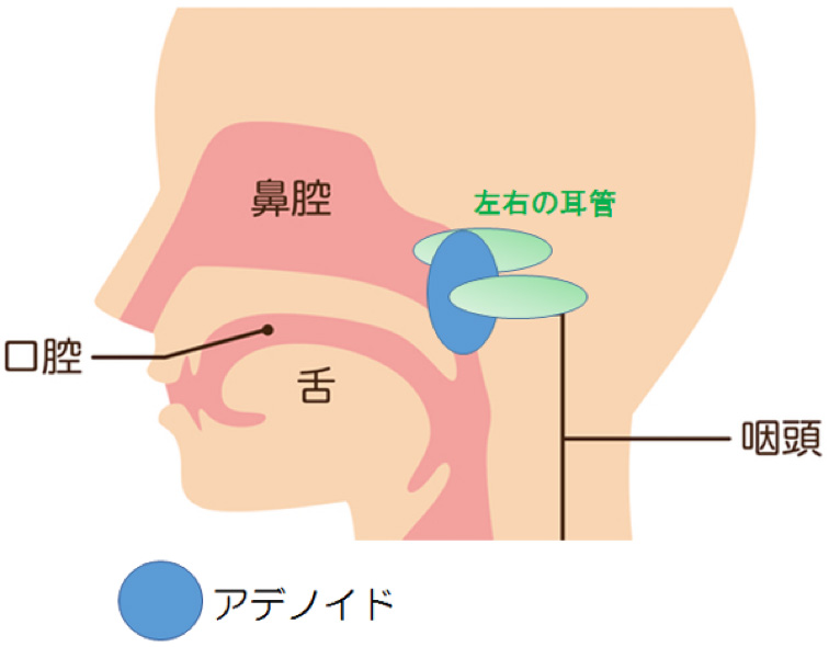 アデノイド顔貌は大人でも治療できる? 3つの改善法と見分け方も紹介 歯科医師監修- SillHa.com - 歯と口と身体の健康メディア -シルハドットコム- SillHa.com - 歯と口と身体の健康メディア -シルハドットコム