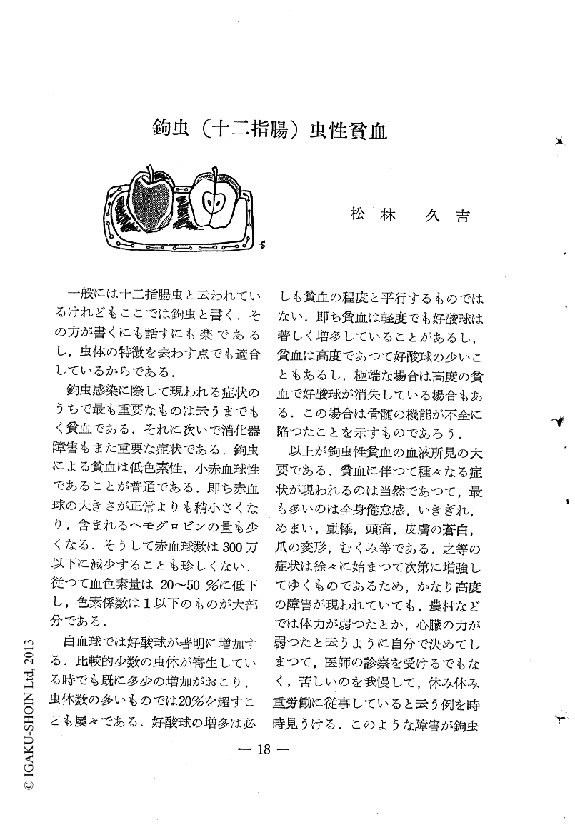 地方病日本住血吸虫症- Wikipedia