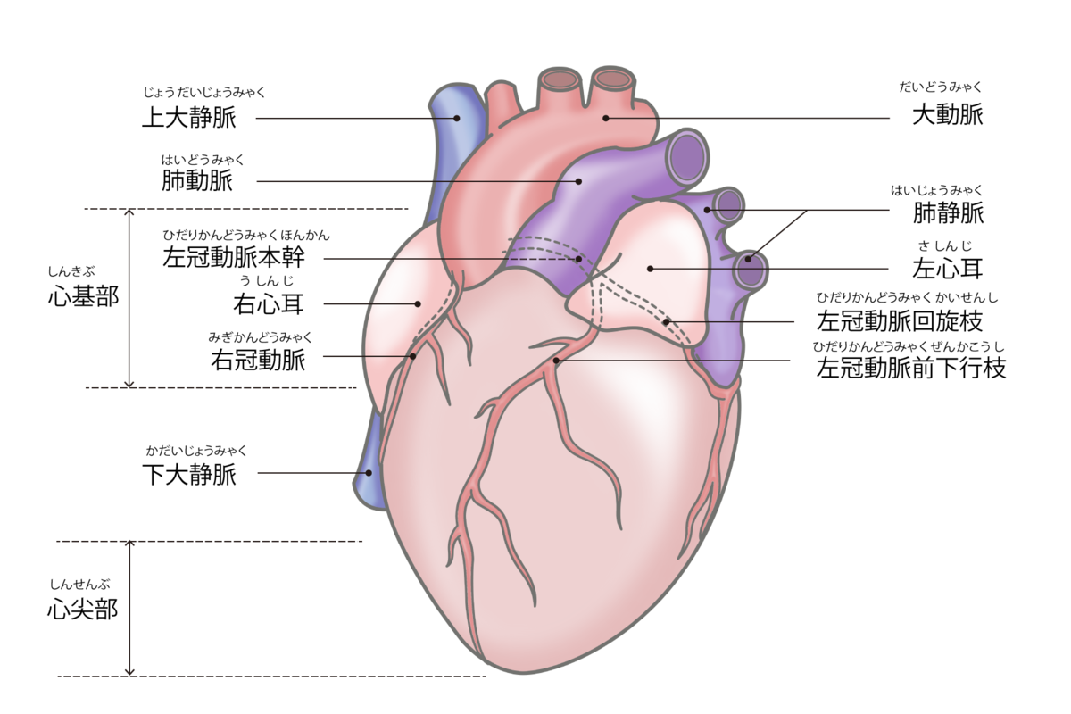 三井記念病院 心房細動での脳梗塞を防ぎ出血合併症を減らす左心耳閉鎖術の低侵襲治療法