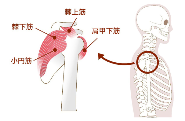 棘上靭帯炎 - 倉敷市ジール鍼灸整骨院 整体院