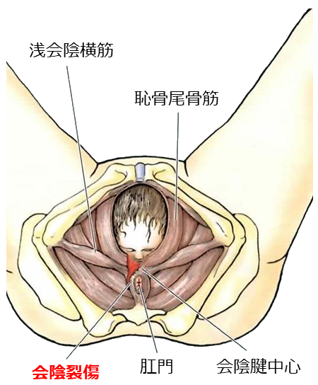 痛すぎ！会陰切開の痛みはいつまで？ピークは？痛くない座り方＆和らげる方法kosodate LIFE 子育てライフ