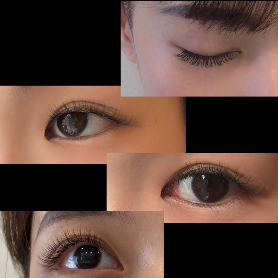 雌雄眼 しゆうがん とは？片目だけ二重になる原因と左右差を整える方法を解説