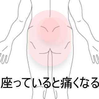 臀部痛品川駅周辺 はりきゅう専門の鍼灸院はりきゅうルーム カポス
