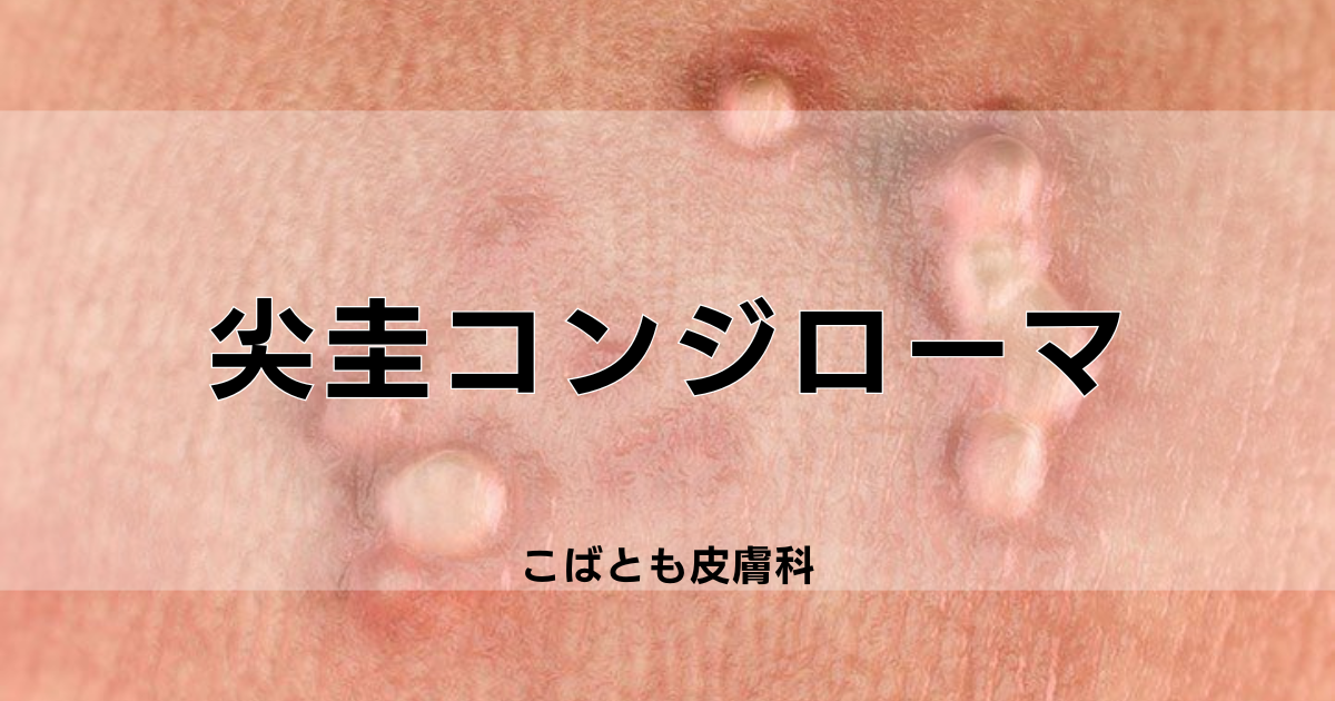 亀頭ブツブツ除去西新宿杉江中央クリニック美容外科・形成外科