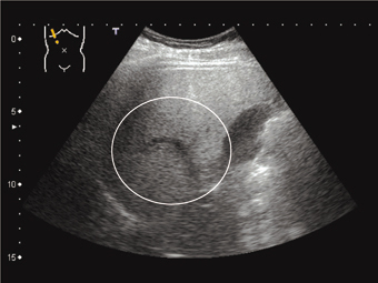 脂肪肝はMRIやCTでわかるのか？石原知明〜四日市消化器病センター肝臓内科医