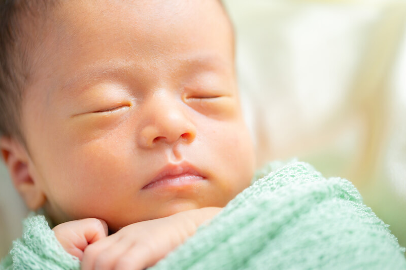 赤ちゃんの肌や白目が黄色いのはなぜ？赤ちゃんの黄疸の原因や治療について 医師監修 ガーデンヒルズウィメンズクリニック福岡市中央区の産婦人科