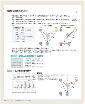心電計 ECG-3250 循環機能検査機器 - 日本光電工業株式会社
