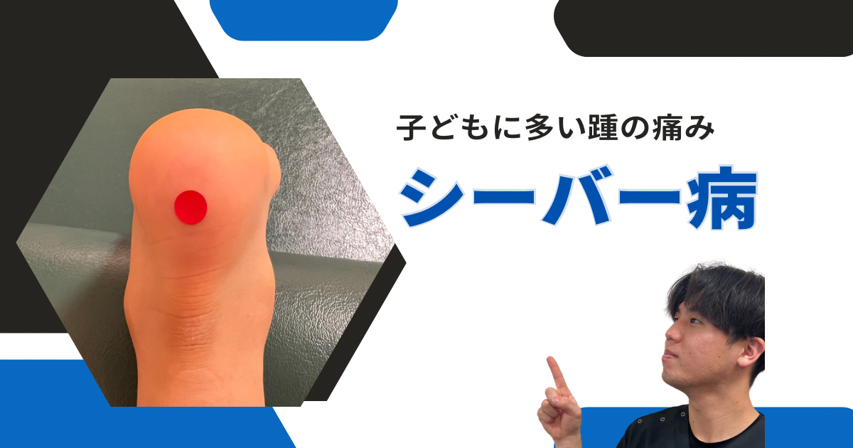 シーバー病の治し方子供の踵の痛みを改善する3つのストレッチと対処方法大阪市西淀川区佃の整体「なかむら鍼灸接骨院」千船駅徒歩4分