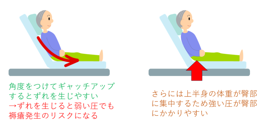 褥瘡 床ずれ とは - バランス株式会社