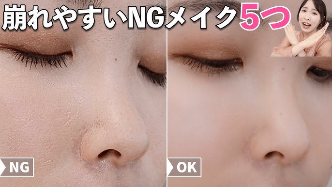 鼻の症状と疾患について茨城県守谷市のほしの耳鼻咽喉科クリニック