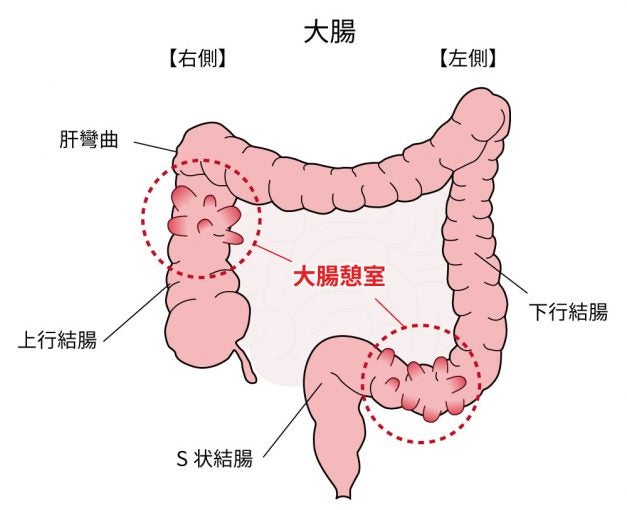 見えた! 停滞便や宿便の位置が自分で分かる方法！健康技 今スグできる！感動の体験！健康裏技