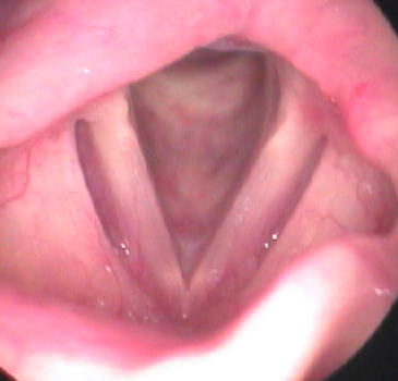 音声外来 声の異常・声帯注射・リハビリ・日帰り手術 東家完院長メトロポリタンENTサージクリニック東京