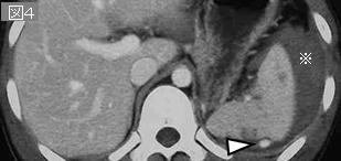 PowerPoint プレゼンテーション