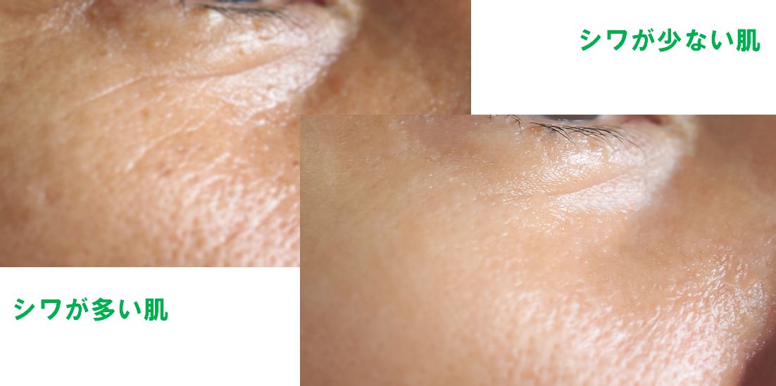 Cosme Life 編集部の白川☆です𓍯🌿 今回は 無印良品のホホバオイルでいちご鼻をつるんとケアする方法 のご紹介です♪🕊𓂃𓏸みなさんご存じ 無印良品 の定番コスメ ホホバオイル を使って いちご鼻 をつるんとケアする方法です☆ ホホバオイルは＃ニキビ のもととなる