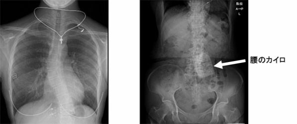 レントゲンに写るもの医療法人社団 玲瓏会 金町中央病院