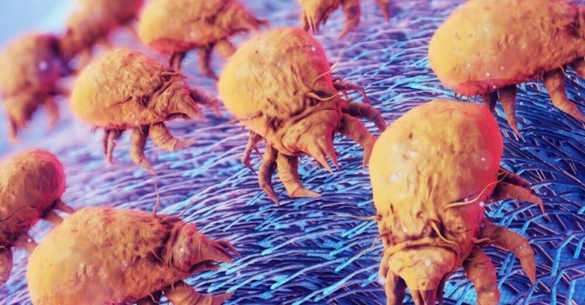 まさかダニ ？」肉眼で見えるダニの退治方法を解説！ オリーブオイルをひとまわしニュース