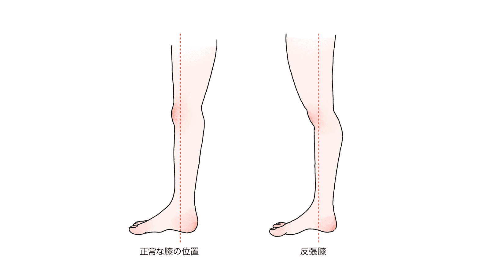 反張膝医療法人社団豊正会 大垣中央病院