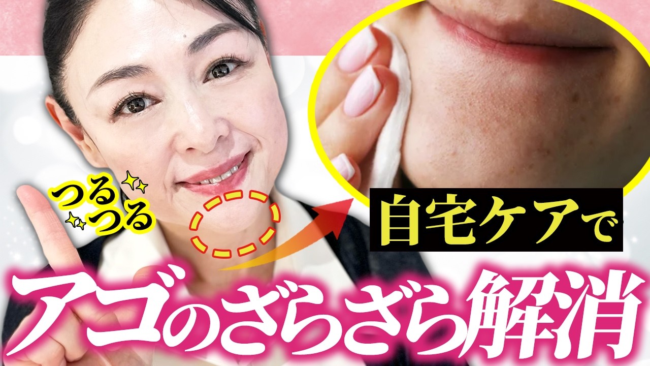 鼻やあごの黒い毛穴対策簡単ケアで正しく除去！ 洗顔料や化粧水などまとめてご紹介美的.com