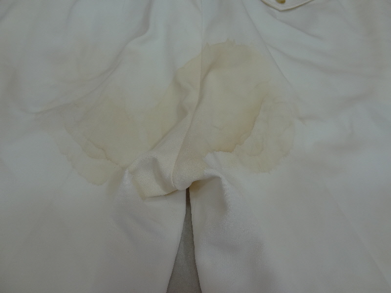 ズボンの尿染み。他店で落ちてこなかったシミ。菊地クリーニング 染み抜きブログ