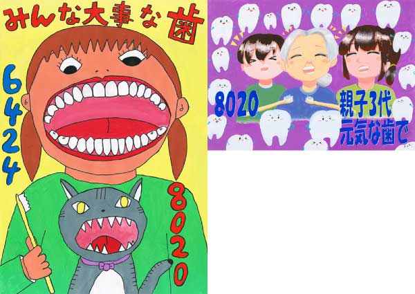 宮崎県：「令和6年度歯と口の健康週間コンクール」で「最優秀賞」を受賞しました