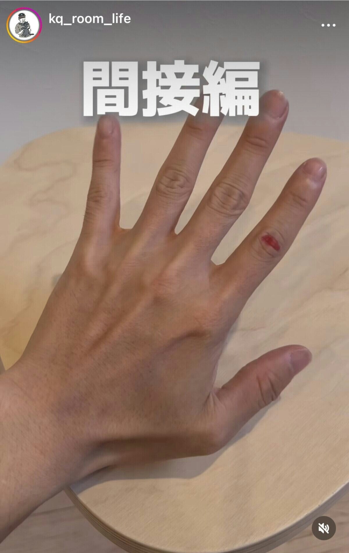 楽天市場 防水サポーター 指テーピング 絆創膏カバー 指関節サポーター 指サポーター 手 小指 突き指 腱鞘炎 指関節サポーター 突き指 腱鞘炎関節サポート リウマチ 水仕事 極薄 ゆびサック 防水 つき指 サポーター くるっとピタッと 指サポーター 2枚入