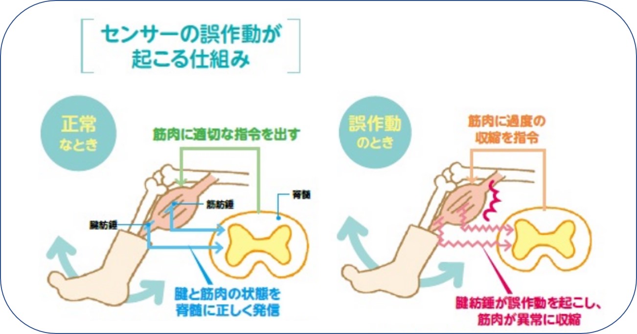 こむら返りに対するテーピング