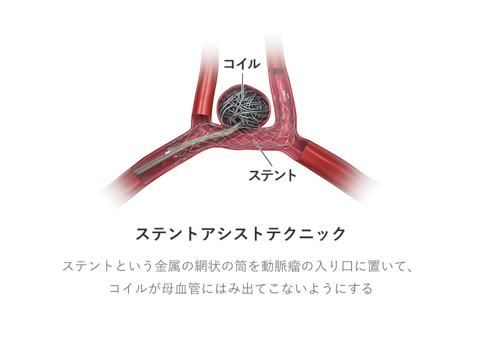 エンボス加工無添加ポリ袋包装資材のfinepack