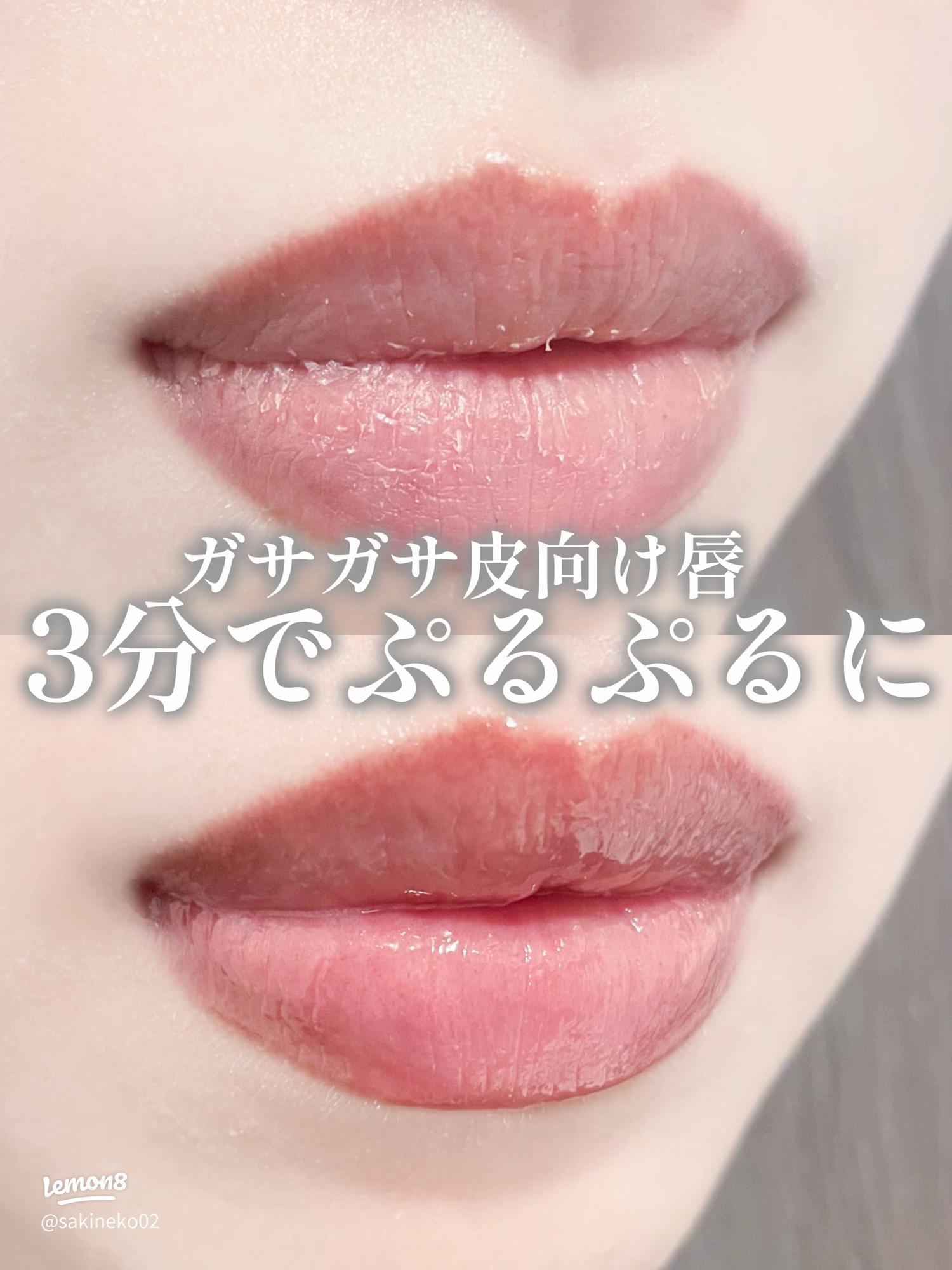 唇の皮をむく癖について - こどもの発達障害・こころの病気 - 日本最大級 医師に相談できるQ&Aサイト アスクドクターズ