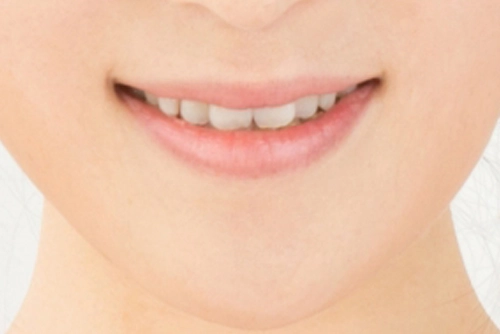 前歯のギザギザの正体とは