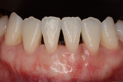 歯周病治療オリオン歯科 アトラスブランズタワー三河島クリニック