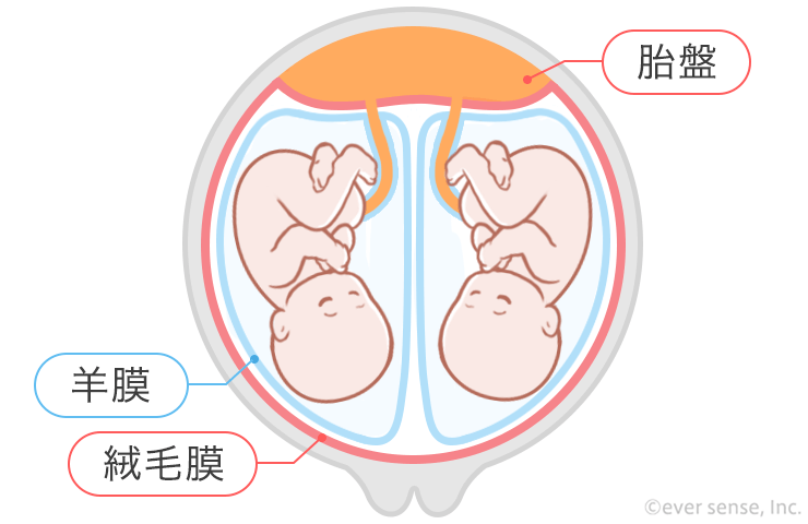 切迫早産とは？原因と治療、知っておきたい大切なこと社会福祉法人交響